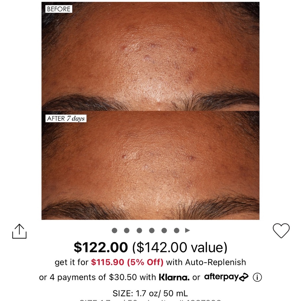Sunday Riley Good Genes All-In-One AHA Lactic Acid Treatment - Picture 6 of 7